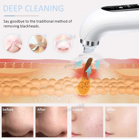 2024 Blackhead Extractor Pore Suction Cleanser USB Rechargeable Beauty Tool