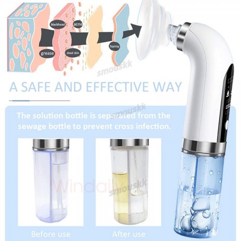 2024 Blackhead Extractor Pore Suction Cleanser USB Rechargeable Beauty Tool